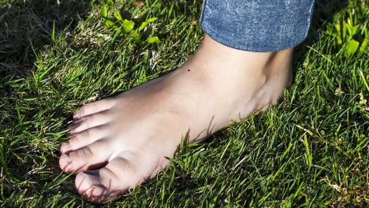 Mole On Right Foot – Meaning For Female and Male